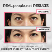 Revitaleyes - Advanced Under-Eye Renewal Therapy
